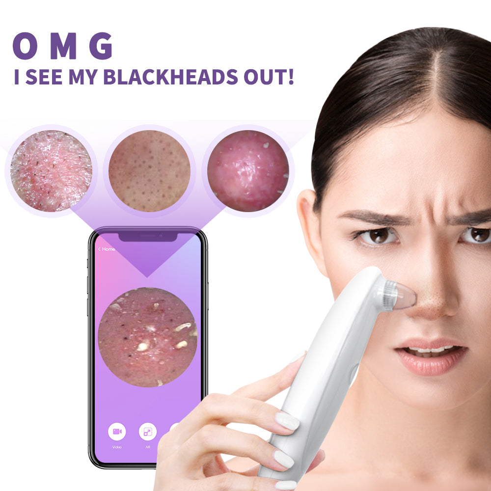 Blackhead Remover